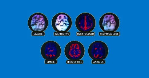 adhd-types adhd-types